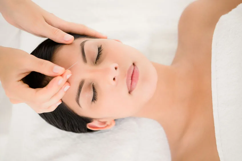 Patient receiving facial acupuncture treatment at Health Pointe Jacksonville